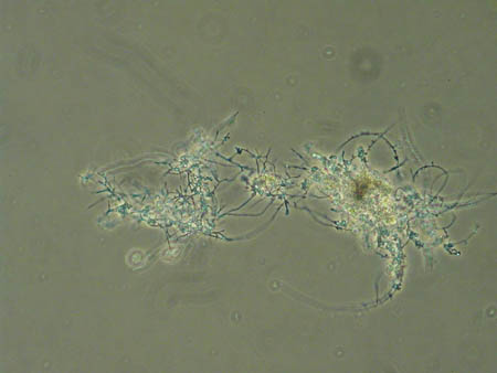 Nocardia 1485