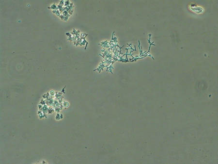 Nocardia 1679