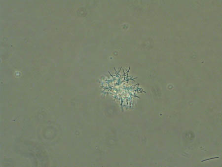 Nocardia 1715