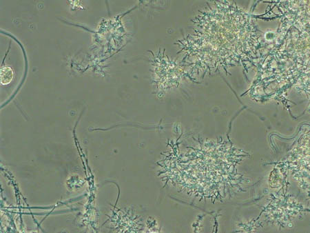 Nocardia 1724