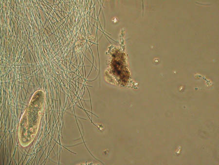 Paramecium 1007