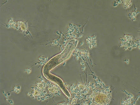 Spirostomum 1405