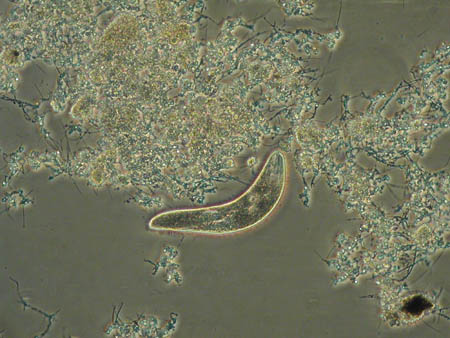 Spirostomum 1410