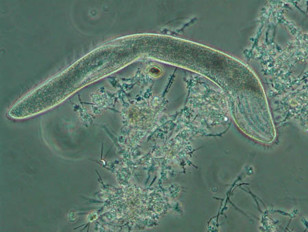 Spirostomum 1981