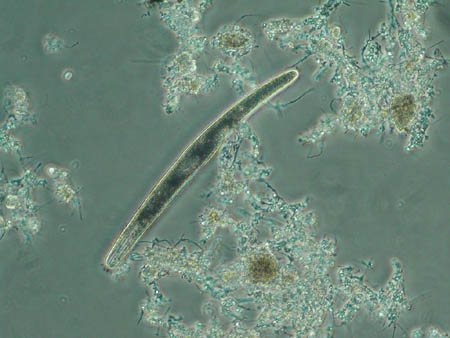 Spirostomum 2736