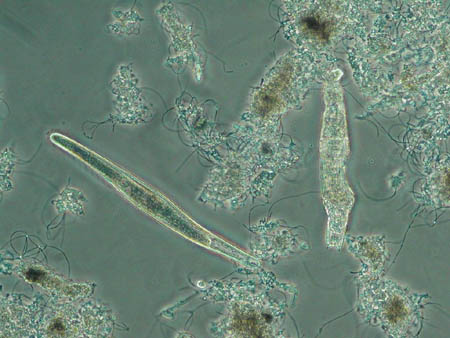 Spirostomum 3038