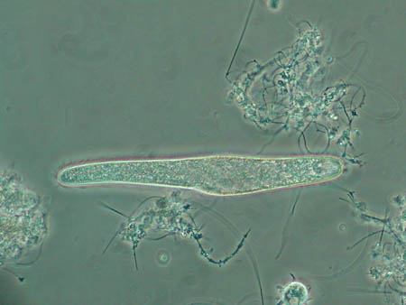 Spirostomum 4700