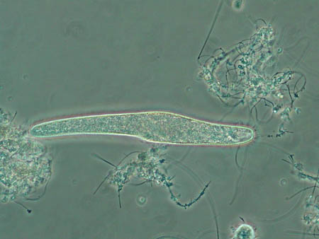 Spirostomum 4701