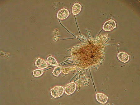 Vorticella 1022