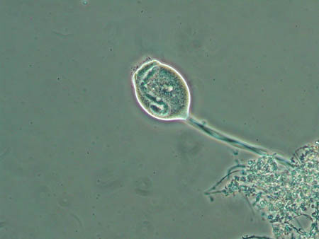 Vorticella 1818