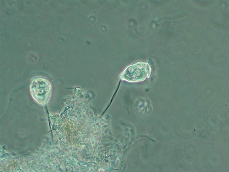 Vorticella 1914