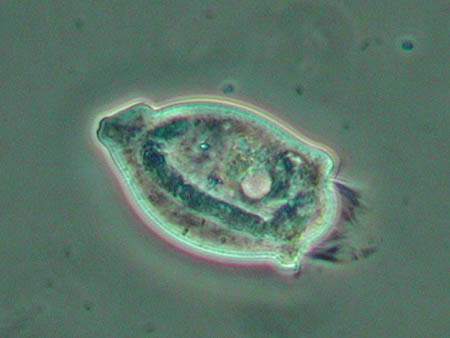 Vorticella 2007