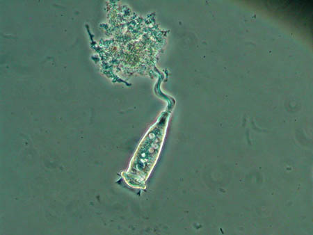 Vorticella 2161