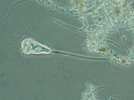 Vorticella 2311