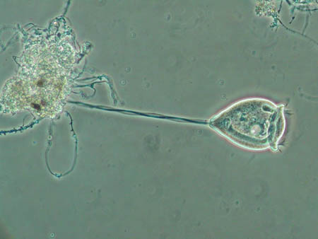 Vorticella 2331