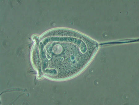 Vorticella 2334