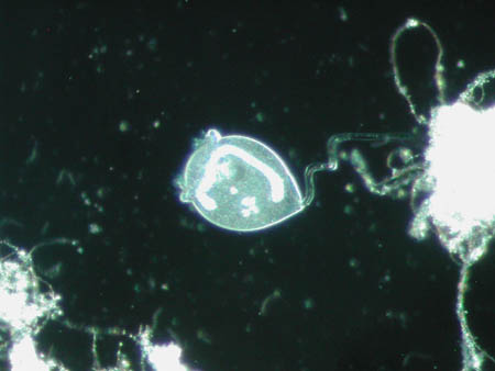 Vorticella 2335