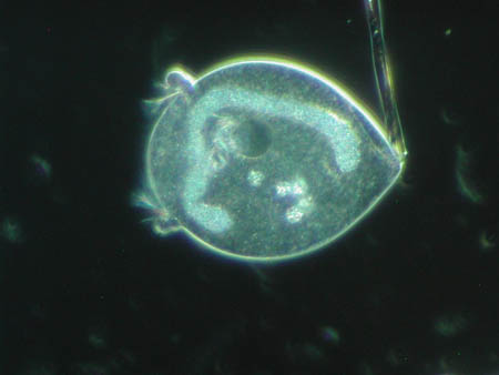 Vorticella 2337